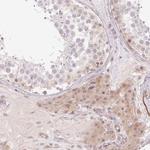 C19orf63 Antibody in Immunohistochemistry (Paraffin) (IHC (P))
