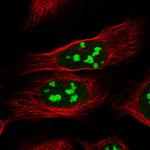 CCDC137 Polyclonal Antibody