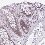 CCDC137 Antibody in Immunohistochemistry (Paraffin) (IHC (P))