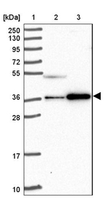 CCDC137 Antibody in Western Blot (WB)