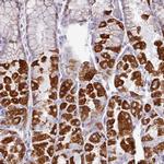 MT-ND4 Antibody in Immunohistochemistry (IHC)