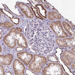 MT-ND4 Antibody in Immunohistochemistry (IHC)