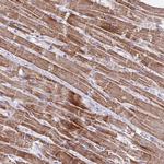 MT-ND4 Antibody in Immunohistochemistry (IHC)