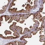 TEKT4 Polyclonal Antibody