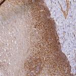 GALP Polyclonal Antibody