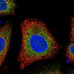 VKORC1L1 Polyclonal Antibody