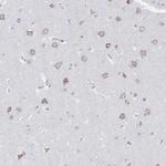 VKORC1L1 Antibody in Immunohistochemistry (Paraffin) (IHC (P))