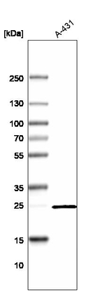 VKORC1L1 Antibody in Western Blot (WB)