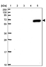 ZNF555 Antibody in Western Blot (WB)