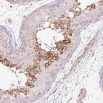 LDHAL6B Antibody in Immunohistochemistry (IHC)