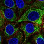 EVPL Polyclonal Antibody