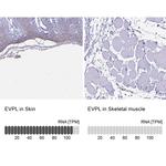 EVPL Antibody in Immunohistochemistry (IHC)