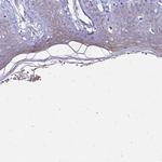 EVPL Antibody in Immunohistochemistry (IHC)