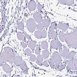EVPL Antibody in Immunohistochemistry (IHC)