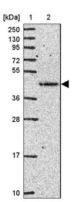 FUT10 Antibody in Western Blot (WB)