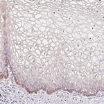 FUT10 Antibody in Immunohistochemistry (IHC)