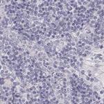 KRT25 Antibody in Immunohistochemistry (IHC)