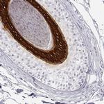 KRT25 Polyclonal Antibody
