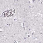 KRT25 Antibody in Immunohistochemistry (IHC)