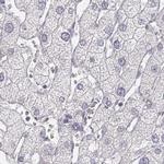 KRT25 Antibody in Immunohistochemistry (IHC)