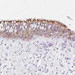 COP1 Polyclonal Antibody