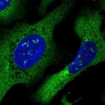 DYNC1I2 Polyclonal Antibody