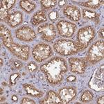 DYNC1I2 Antibody in Immunohistochemistry (Paraffin) (IHC (P))