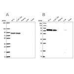 DYNC1I2 Antibody in Western Blot (WB)