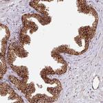 SLC39A7 Antibody in Immunohistochemistry (IHC)