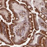 SLC39A7 Antibody in Immunohistochemistry (IHC)
