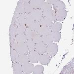 SLC39A7 Antibody in Immunohistochemistry (IHC)