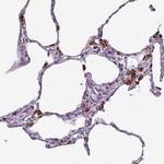 Alivin 1 Antibody in Immunohistochemistry (Paraffin) (IHC (P))