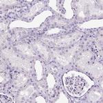 SP8 Antibody in Immunohistochemistry (Paraffin) (IHC (P))