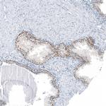 SP8 Antibody in Immunohistochemistry (Paraffin) (IHC (P))
