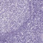 SP8 Antibody in Immunohistochemistry (Paraffin) (IHC (P))