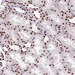 TMEM184C Antibody in Immunohistochemistry (Paraffin) (IHC (P))