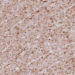TRA2A Antibody in Immunohistochemistry (IHC)