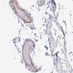 EML5 Polyclonal Antibody