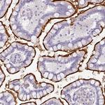 OR52N1 Polyclonal Antibody