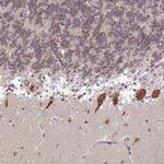 TMEM246 Polyclonal Antibody