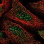 FAM46C Polyclonal Antibody