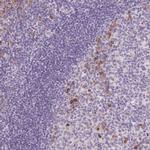 FAM46C Antibody in Immunohistochemistry (Paraffin) (IHC (P))
