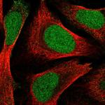 ZNF580 Polyclonal Antibody