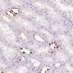 TMEM213 Antibody in Immunohistochemistry (Paraffin) (IHC (P))