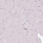 TMEM213 Antibody in Immunohistochemistry (Paraffin) (IHC (P))