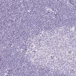 TMEM213 Polyclonal Antibody