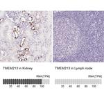 TMEM213 Antibody in Immunohistochemistry (IHC)