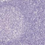 TMEM213 Antibody in Immunohistochemistry (IHC)