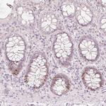 TREX2 Antibody in Immunohistochemistry (Paraffin) (IHC (P))