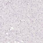 TREX2 Antibody in Immunohistochemistry (Paraffin) (IHC (P))